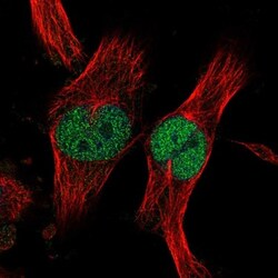 ZNF277 Antibody, Novus Biologicals 0.1mL; Unlabeled:Antibodies, Polyclonal